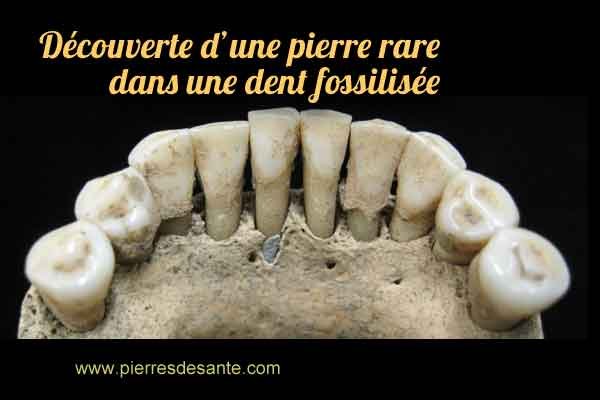 Découverte d’une pierre rare de lapis-lazuli dans une dent fossilisée